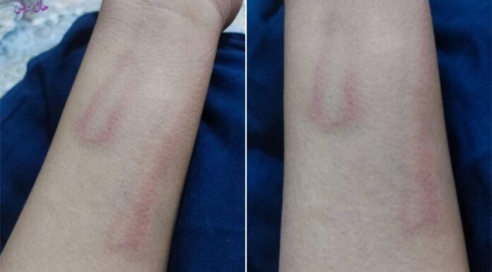 بنپور ، اسکول کے پرنسپل کے ہاتھوں متعدد طلبا کو جسمانی سزا دی گئی