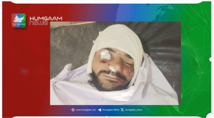 پنجگور چتکان قابض فورسز کی گھر پر فائرنگ ایک شخص جانبحق